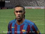 Ronaldinho et ses dents